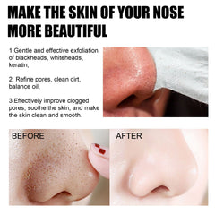 EELHOE Blackhead Removal Nasal Mask Deep Pore Cleansing Blackheads & Acne Rip-Off Nasal Mask