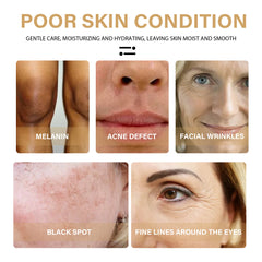 EELHOE Turmeric Dark Spot Correction Face Care Spot Moisturizing And Repairing Skin Tone Serum