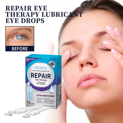 EELHOE Eye Drops Relieve Redness And Blurred Eyes Eye Fatigue Dryness Blurred Vision Moisturizing Eye Care Solution