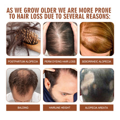 EELHOE Batana Oil Conditioner Moisturizes, Repairs, Strengthens Hair Roots, Prevents Supple, Dense Hair, And Solidifies And Fluffy Hair