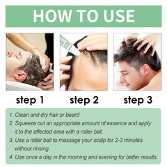 West&Month Hair Roller Balls Scalp Massage Moisturizing Hair Roots Thickening Hair Hair Treatment Roller Balls Essential Oil